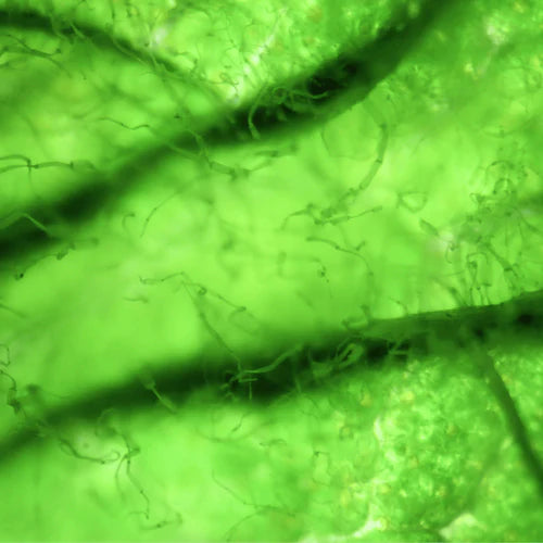 DHAgold: microalgae omega 3 fatty acid